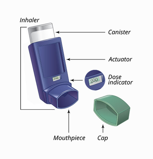Buy Ventolin Inhaler Usa